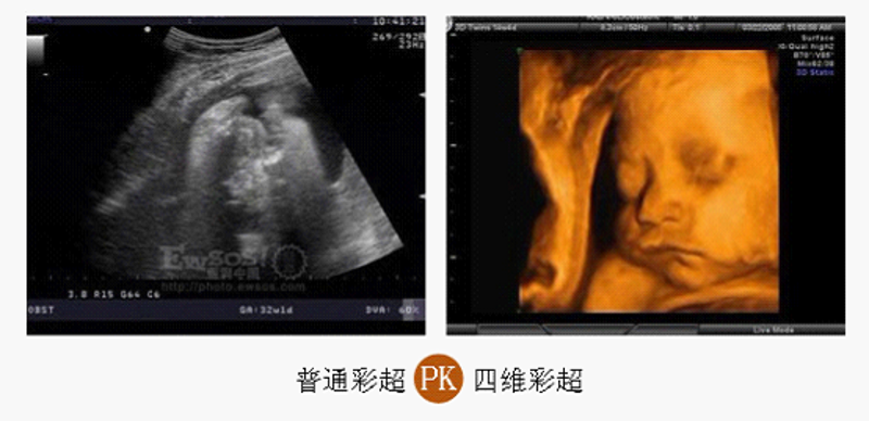 孕期检查,为您和宝宝撑起健康的保护伞